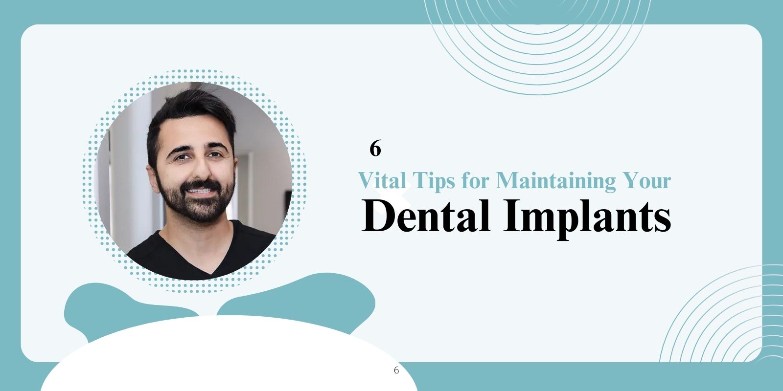 6 Vital Tips for Maintaining Your Dental Implants